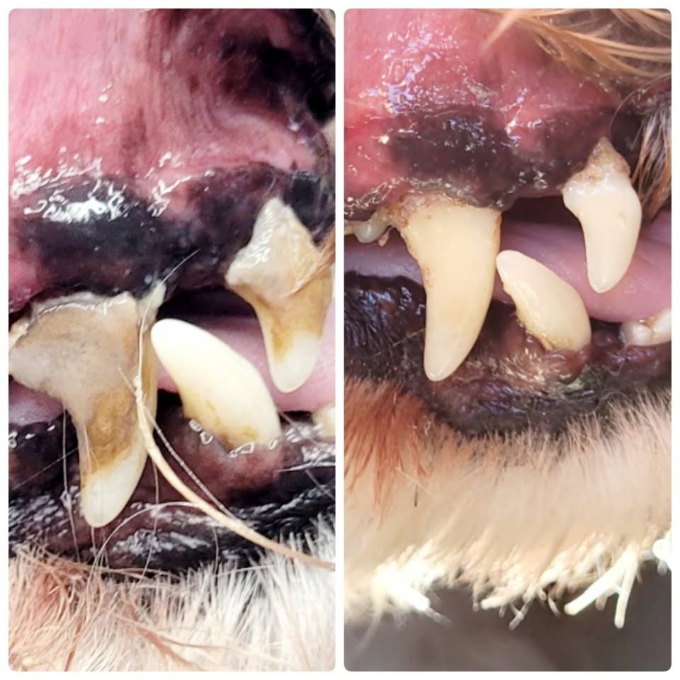 Before and after results from a tooth by tooth dental cleaning